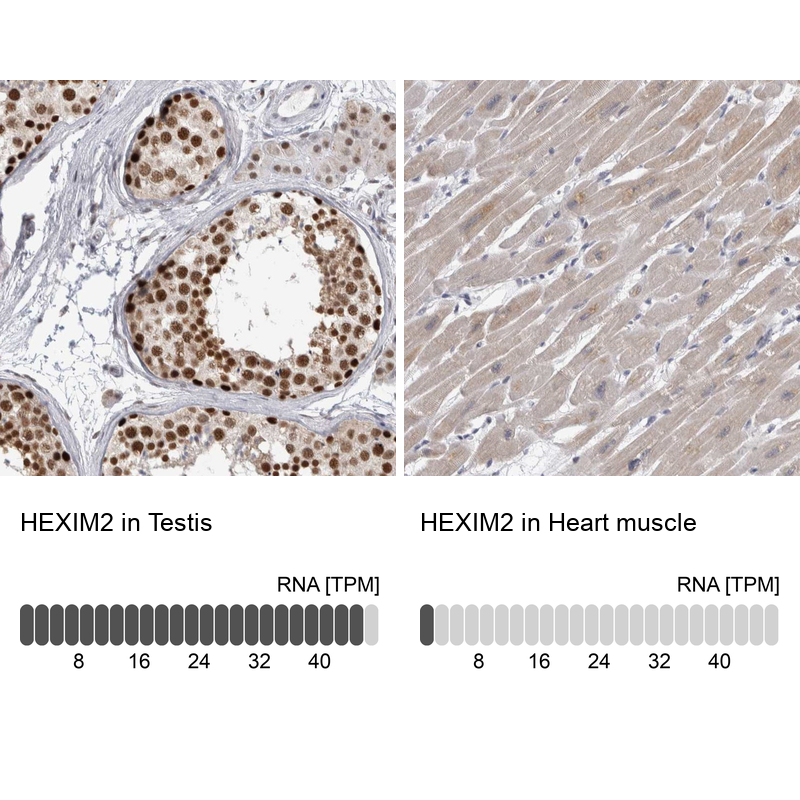 Anti-HEXIM2 Antibody