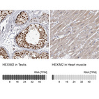 Anti-HEXIM2 Antibody