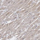 Immunohistochemical staining of human heart muscle shows low expression as expected.