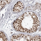 Immunohistochemical staining of human testis shows high expression.