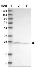 Lane 1: Marker [kDa] 230, 130, 95, 72, 56, 36, 28, 17, 11_br/_Lane 2: Human cell line RT-4_br/_Lane 3: Human cell line U-251MG sp