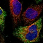 Immunofluorescent staining of human cell line U-2 OS shows positivity in cytoplasm.