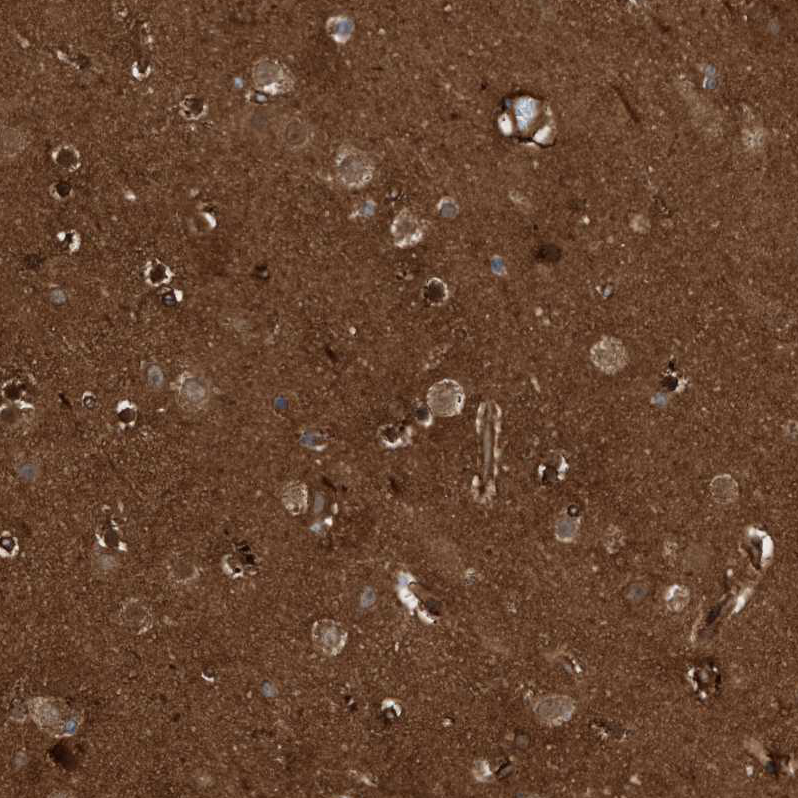 Anti-CDC42EP4 Antibody