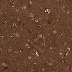 Anti-CDC42EP4 Antibody