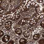 Immunohistochemical staining of human small intestine shows strong membranous and cytoplasmic positivity in glandular cells.