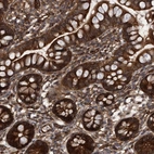 Immunohistochemical staining of human small intestine shows strong membranous and cytoplasmic positivity in glandular cells.