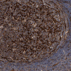 Immunohistochemical staining of human tonsil shows strong membranous and cytoplasmic positivity in germinal center cells.