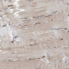 Immunohistochemical staining of human skeletal muscle shows very weak cytoplasmic positivity in myocytes.