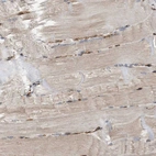 Immunohistochemical staining of human skeletal muscle shows very weak cytoplasmic positivity in myocytes.