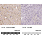 Anti-CNP Antibody