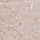 Anti-CNP Antibody