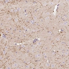 Immunohistochemical staining of human cerebral cortex shows high expression.