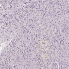 Immunohistochemical staining of human pancreas shows low expression as expected.