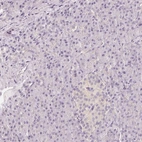 Immunohistochemical staining of human pancreas shows low expression as expected.