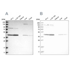 Anti-CNP Antibody