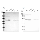 Western blot analysis using Anti-CNP antibody HPA023338 (A) shows similar pattern to independent antibody HPA023266 (B).
