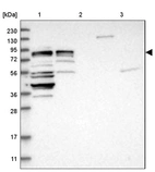 Lane 1: Marker [kDa] 230, 130, 95, 72, 56, 36, 28, 17, 11_br/_Lane 2: Human cell line RT-4_br/_Lane 3: Human cell line U-251MG sp