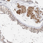 Anti-TSTA3 Antibody