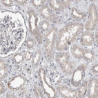 Immunohistochemical staining of human kidney shows weak cytoplasmic positivity in cells in tubules.