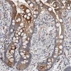 Immunohistochemical staining of human colon shows moderate cytoplasmic positivity in glandular cells.