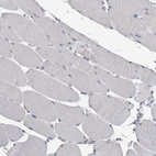 Immunohistochemical staining of human skeletal muscle shows no cytoplasmic positivity in myocytes as expected.