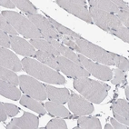 Immunohistochemical staining of human skeletal muscle shows no cytoplasmic positivity in myocytes as expected.