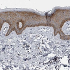 Immunohistochemical staining of human skin shows moderate cytoplasmic positivity in squamous epithelial cells.