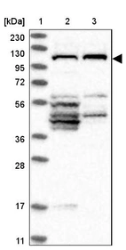 Lane 1: Marker [kDa] 230, 130, 95, 72, 56, 36, 28, 17, 11_br/_Lane 2: Human cell line RT-4_br/_Lane 3: Human cell line U-251MG sp