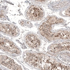 Immunohistochemical staining of human testis shows moderate cytoplasmic positivity in cells in seminiferous ducts.