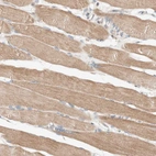 Immunohistochemical staining of human skeletal muscle shows cytoplasmic positivity in myocytes.