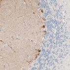 Immunohistochemical staining of human cerebellum shows moderate cytoplasmic positivity in Purkinje cells.