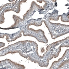 Immunohistochemical staining of human fallopian tube shows moderate cytoplasmic positivity in glandular cells.