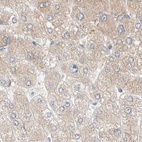 Anti-PCM1 Antibody