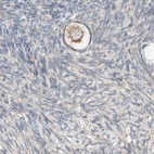Immunohistochemical staining of human ovary using Anti-PCM1 antibody HPA023370.