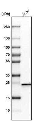 Western blot analysis in human liver tissue.