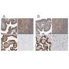 Immunohistochemical staining of human fallopian tube, lymph node, placenta and skeletal muscle using Anti-LRRC45 antibody HPA023372 (A) shows similar protein distribution across tissues to independent antibody HPA023382 (B).