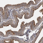 Immunohistochemical staining of human fallopian tube shows high expression.
