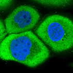 Immunofluorescent staining of human cell line A-431 shows localization to plasma membrane, cytosol & centrosome.