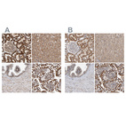 Anti-MRPL45 Antibody