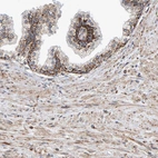 Immunohistochemical staining of human prostate shows moderate granular cytoplasmic positivity in glandular cells.