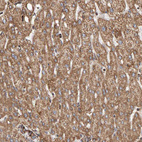 Immunohistochemical staining of human liver shows moderate granular cytoplasmic positivity in hepatocytes.