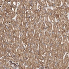 Immunohistochemical staining of human liver shows moderate granular cytoplasmic positivity in hepatocytes.