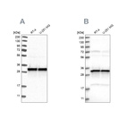 Western blot analysis using Anti-MRPL45 antibody HPA023373 (A) shows similar pattern to independent antibody HPA023385 (B).
