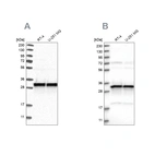 Western blot analysis using Anti-MRPL45 antibody HPA023373 (A) shows similar pattern to independent antibody HPA023385 (B).