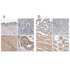 Anti-PCM1 Antibody