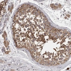 Immunohistochemical staining of human testis shows moderate to strong cytoplasmic positivity in cells in seminiferous ducts.