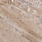 Immunohistochemical staining of human skeletal muscle shows moderate cytoplasmic positivity in myocytes.