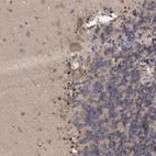 Immunohistochemical staining of human cerebellum shows moderate cytoplasmic positivity in Purkinje cells.