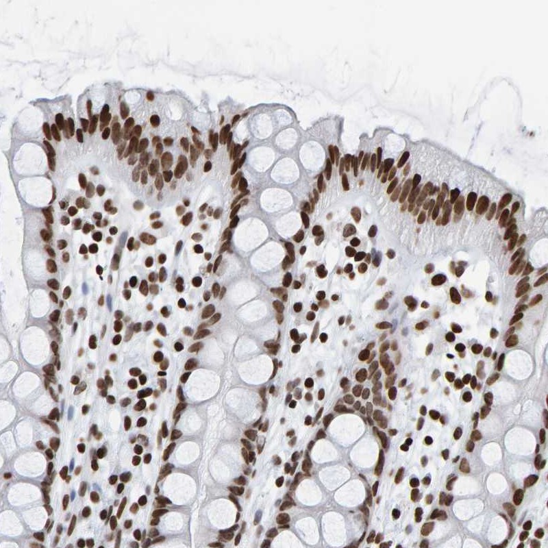 Anti-BRF2 Antibody