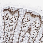 Anti-BRF2 Antibody